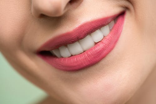 La parodontite : qu'est-ce que c'est ?